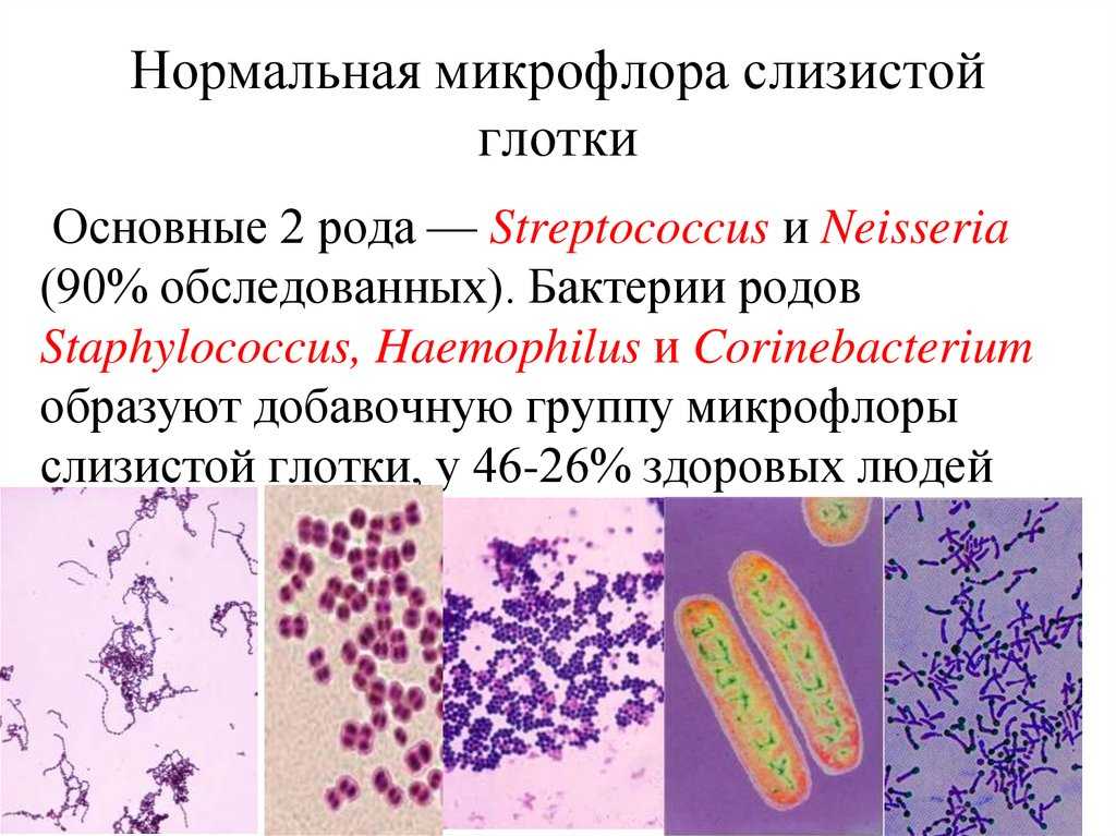 Микрофлора различных продуктов питания презентация, доклад, проект на тему