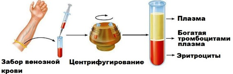 Сепарирование крови (часть 6) » строительный портал: новости, статьи, обзоры