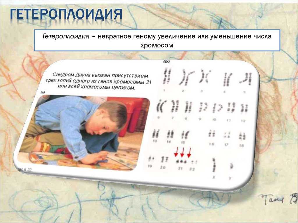 Изменчивость и генетика человека #54