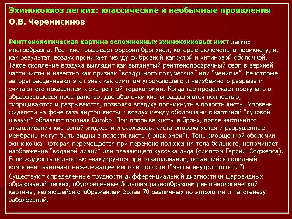 Описторхоз