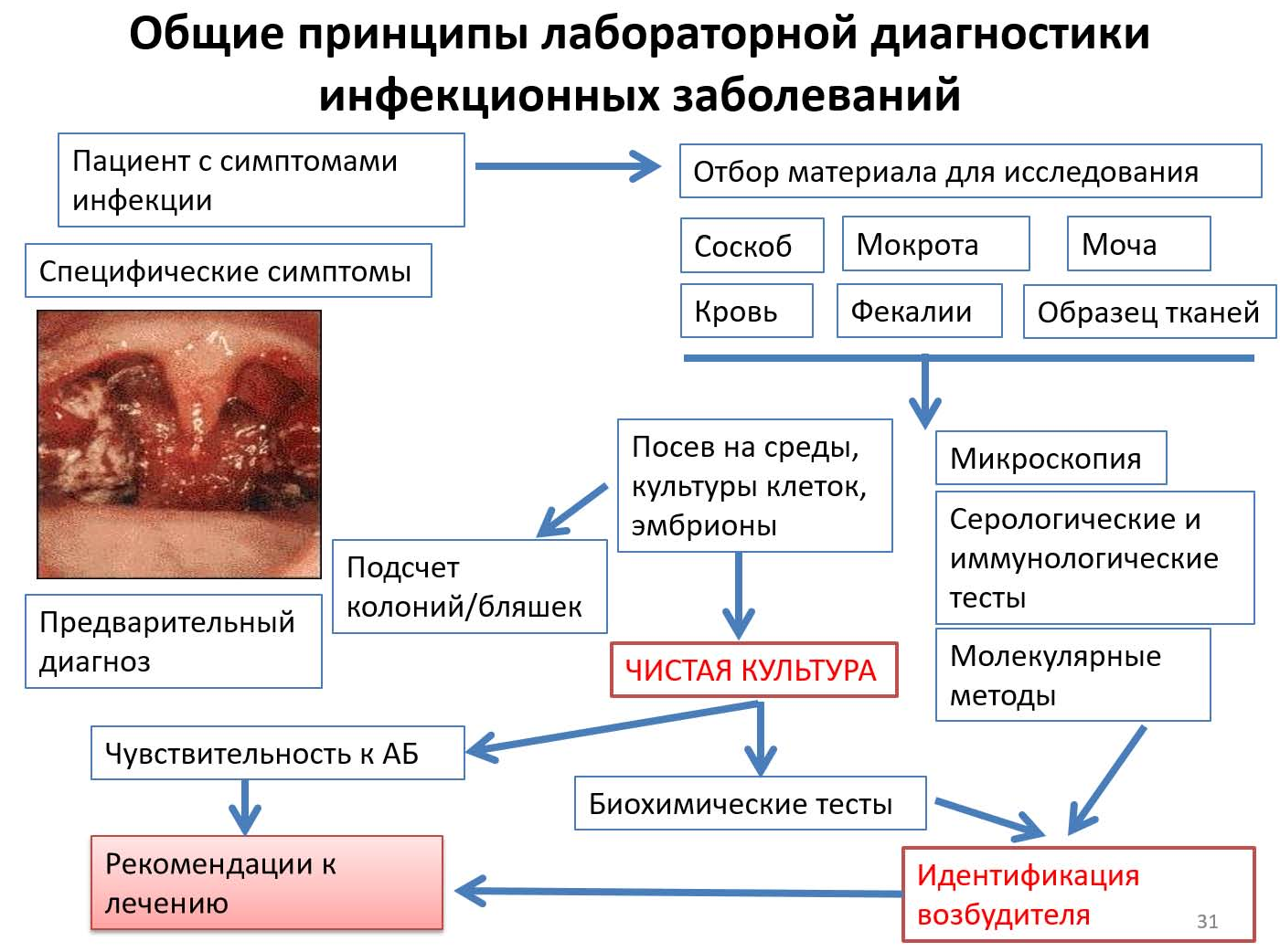 Бруцеллез