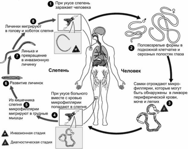 Онхоцеркоз - симптомы болезни, профилактика и лечение онхоцеркоза, причины заболевания и его диагностика на eurolab