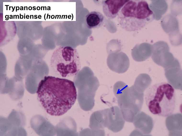 Трипаносомоз животных - animal trypanosomiasis - dev.abcdef.wiki