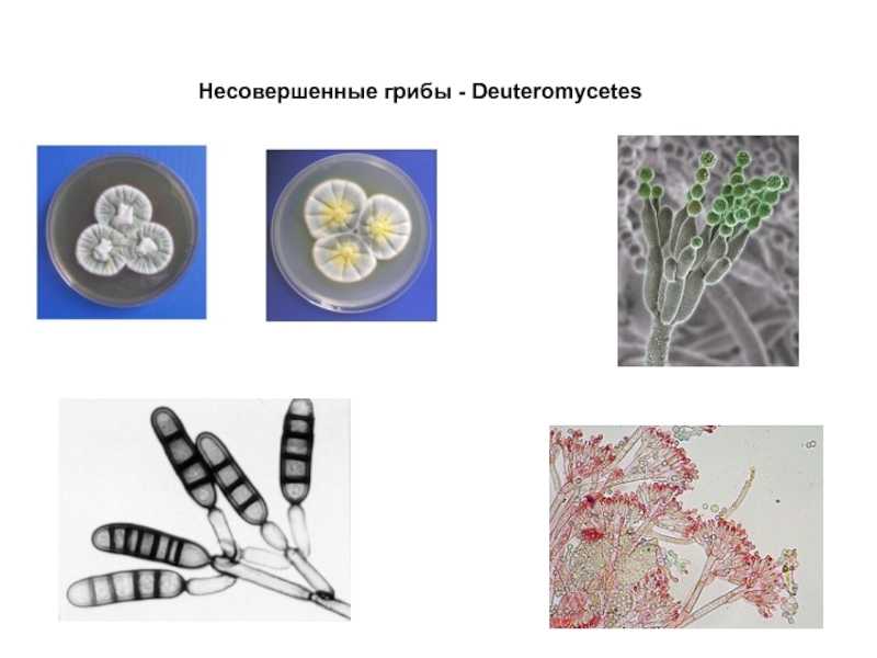Подкласс: taphrinomycetidae (тафриномицетовые)