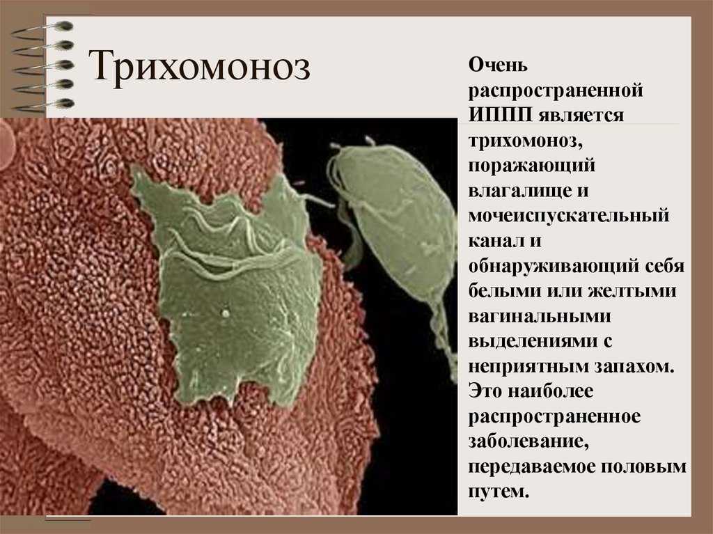 Трихомоноз у кур: симптомы, диагностика, лечение, меры профилактики, препараты
