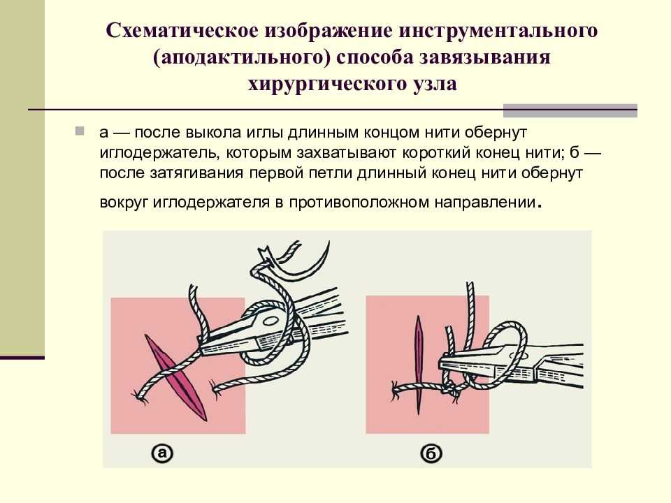Сколько заживают швы после операции?