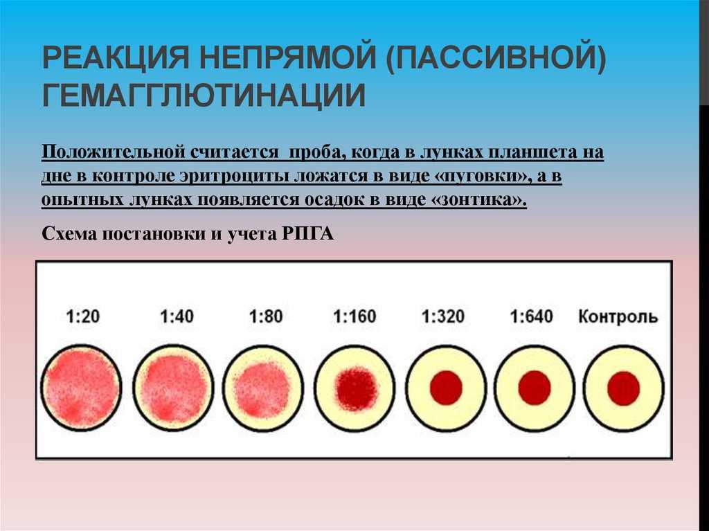 Диагностика брюшного типа