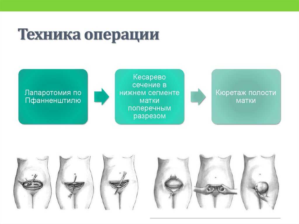 Реферат: кесарево сечение коров