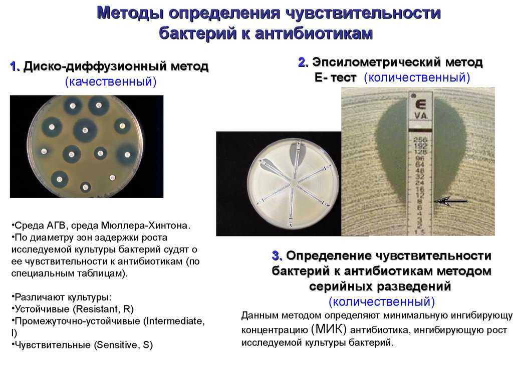 Определение чувствительности бактерий к антибиотикам методом дисков и серийных разведений