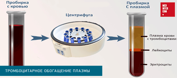 Сепаратор для крови