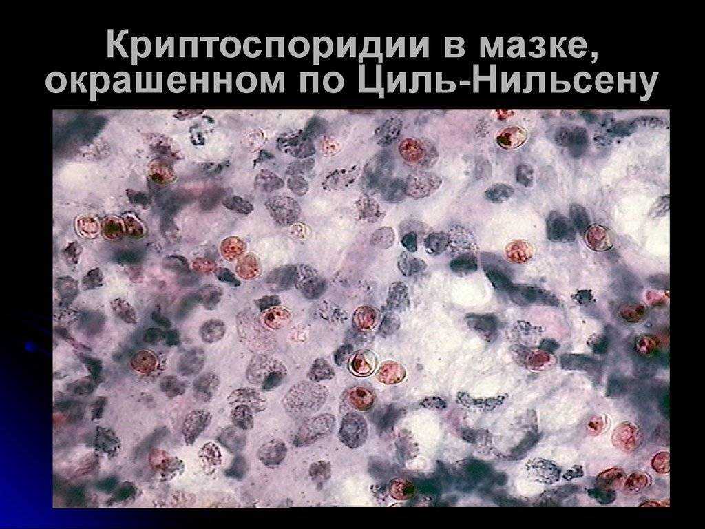 Криптоспоридиоз у человека и животных: кто возбудитель, какие симптомы, диагностика и лечение