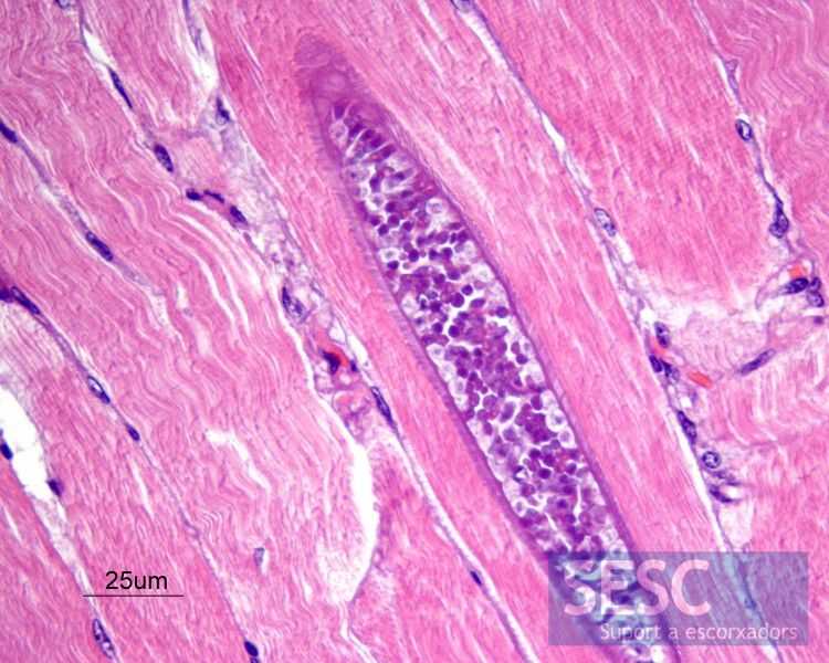 Саркоцистоз виды, признаки, лечение | medded.ru