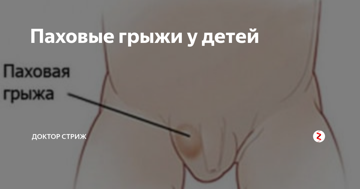 Грыжа пупочная у поросят