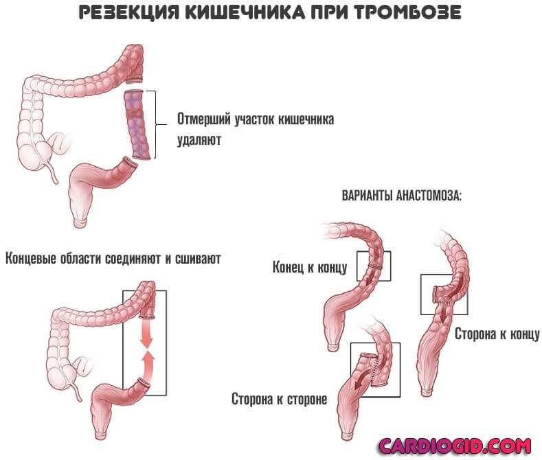 Выпадение прямой кишки у кошки: операция, лечение - zoosecrets
