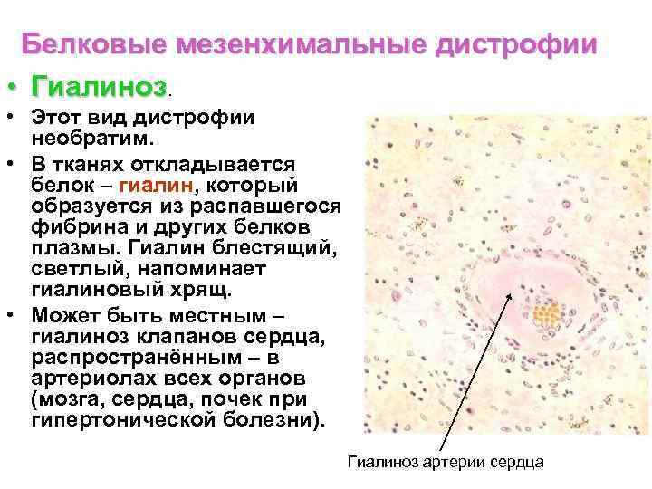 Мелкоклеточные опухоли костей и мягких тканей (морфологическая характеристика, прогноз, лечебный патоморфоз) - автореферат диссертации по медицине скачать бесплатно на тему 'онкология', специальность вак рф 14.00.14