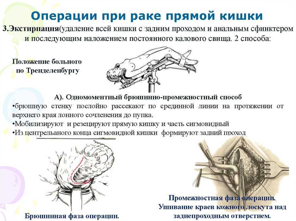 Автореферат и диссертация по ветеринарии (16.00.05) на тему:использование компрессионных круговых анастомозов при операциях на кишечнике у собак