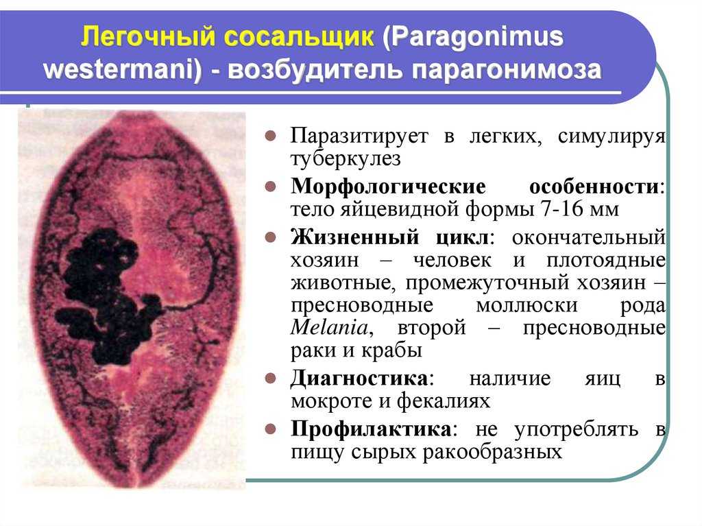 Парагонимоз человека