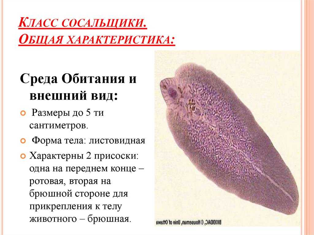 Презентация на тему "общая характеристика гельминтов"