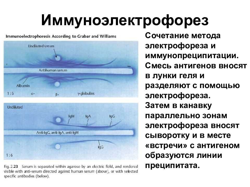 Возрастание роли иммунологии в период пандемии. укрепление иммунитета и профилактика заболеваемости  >> встречный электрофорез