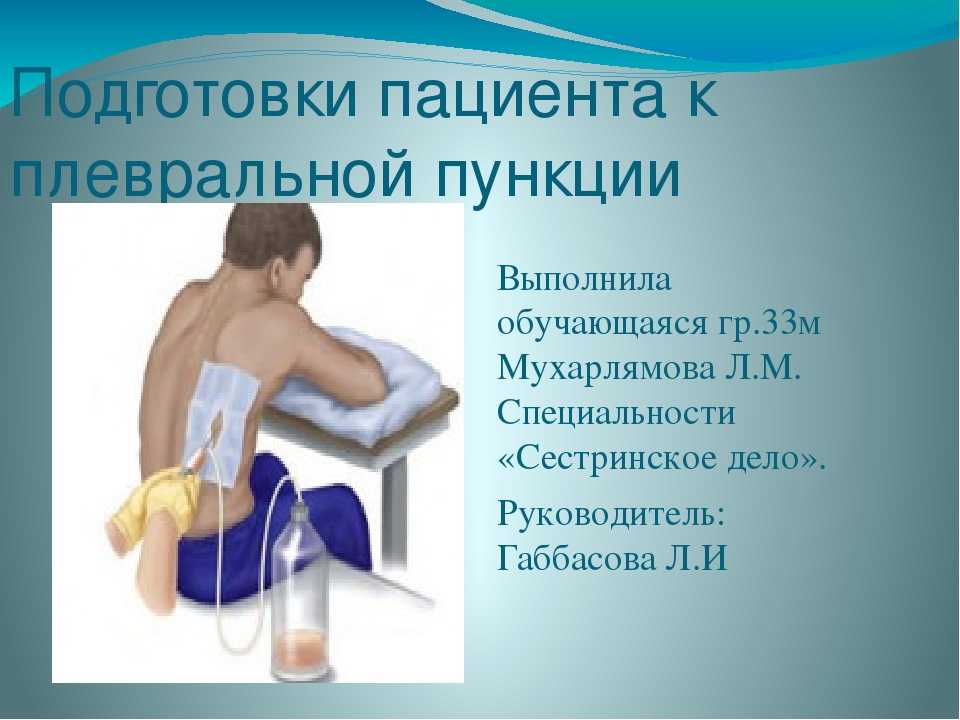 Плевральная пункция - алгоритм выполнения, подготовка и результаты