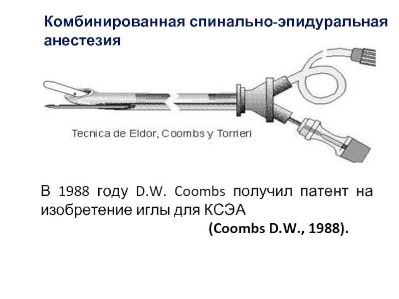 Техника выполнения эпидуральной и спинальной анестезии. эпидуральная и спинальная анестезия - реферат