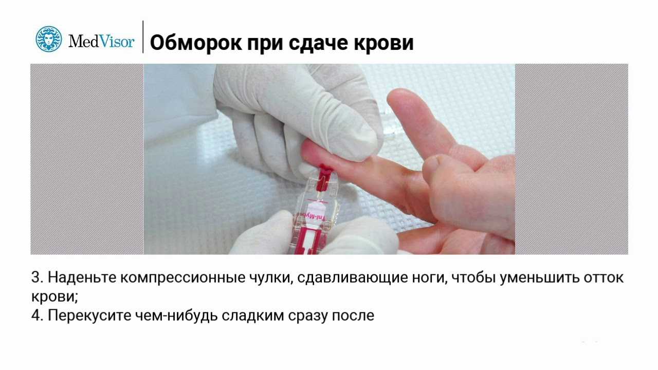 Раздел ii. нарушения крово- и лимфообращения