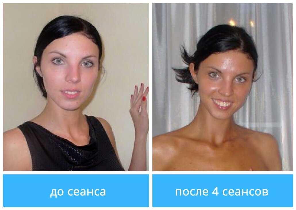 Почему в горах быстрее загорают