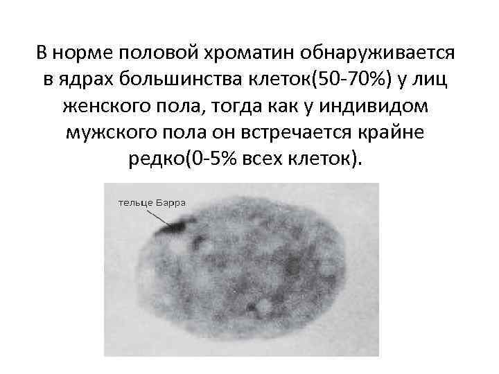 Половой хроматин