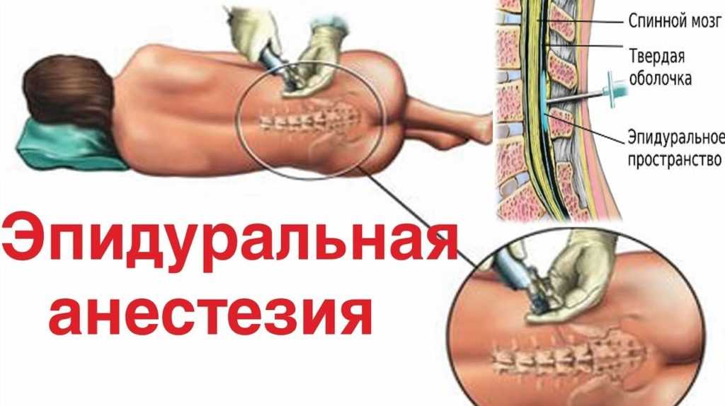 Регионарные методы анестезии для детей