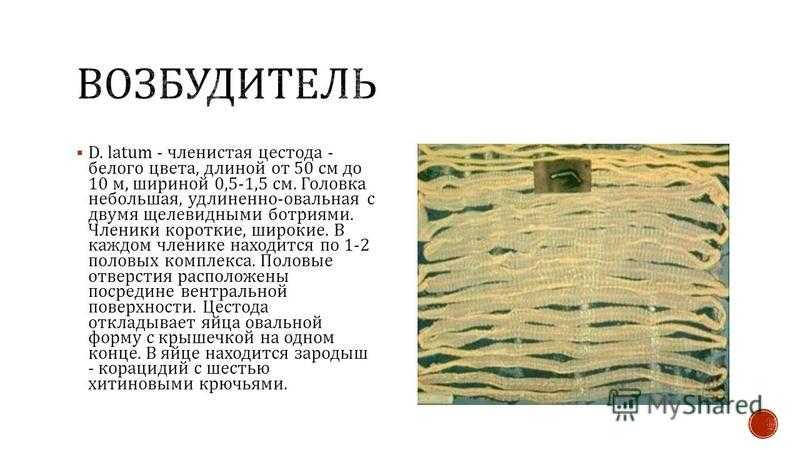 Болезни, вызываемые гельминтами (гельминтозы) [1979 корзюков ю.а. - болезни аквариумных рыб]