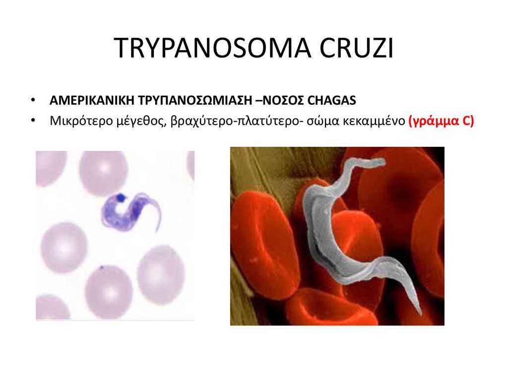 Трипаносомоз животных - animal trypanosomiasis