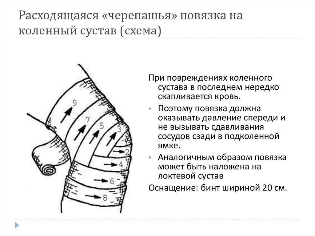 Виды повязок и способы их наложения - aviclinic.ru