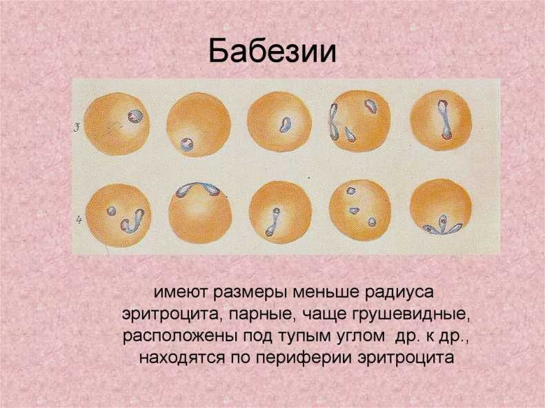 Признаки и паразитология пироплазмоза у крс, симптомы и лечение
