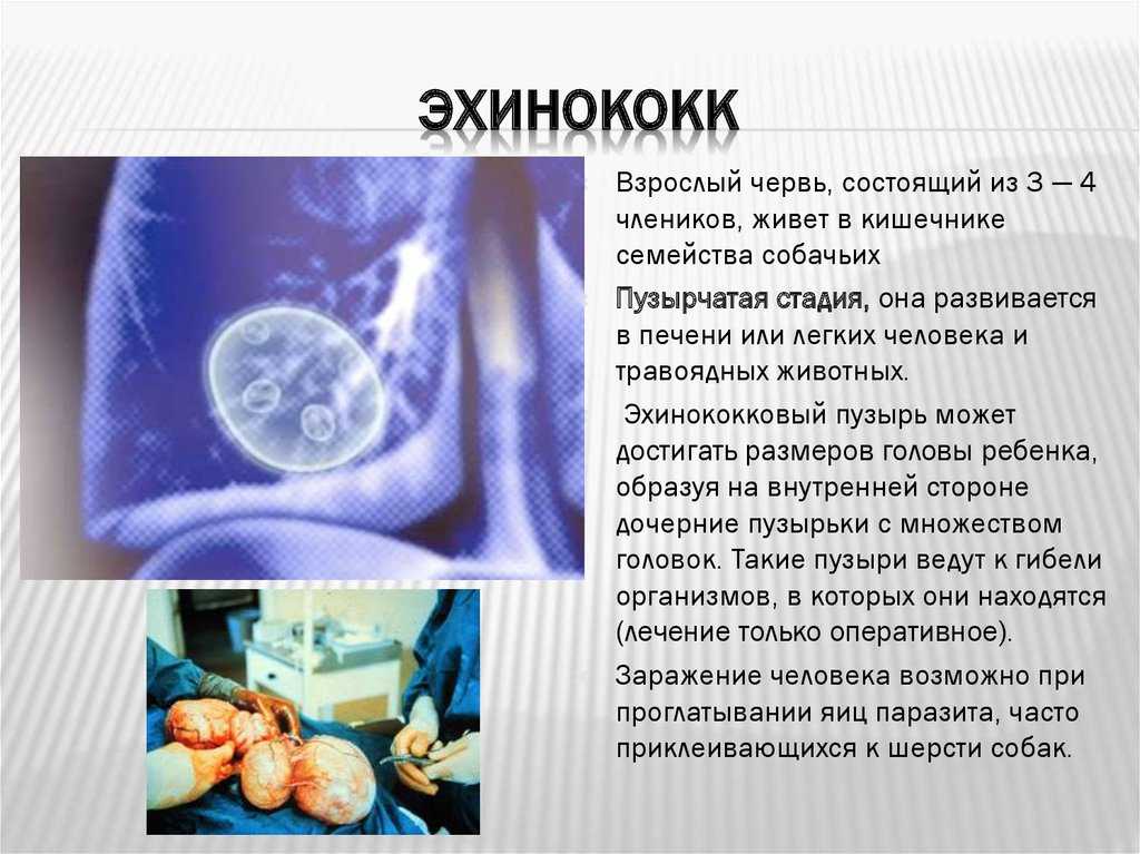 Эхинококкоз у животных курсовая работа