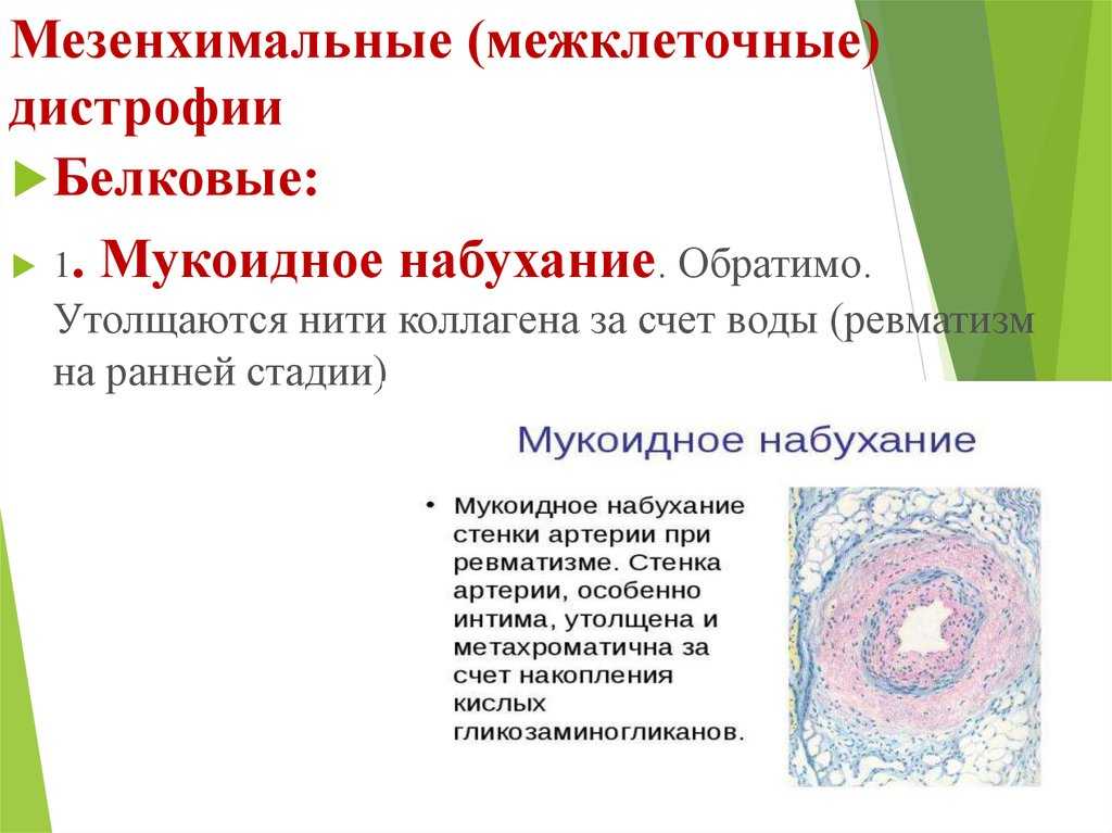 Опорный конспект. изучаемые вопросы ответы некрозом или омертвением называется гибель клеток, тканей или органов, наступившая в живом организме. наиболее часто