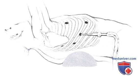 Тема №13: «топографическая анатомия области холки, грудной и брюшной областей»