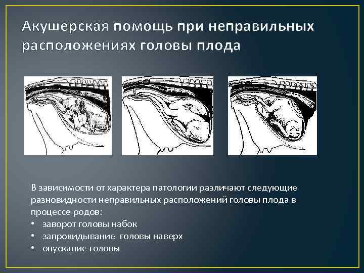 Как рожают собаки: предвестники, этапы, препараты и нужен ли хозяину «декретный отпуск»