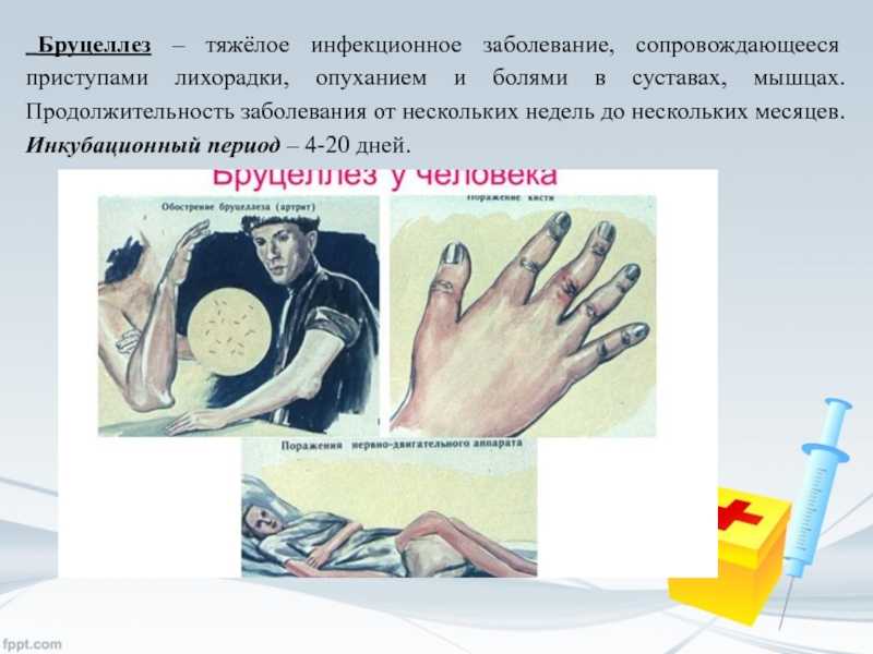 Бруцеллез у крс