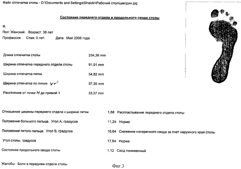 Способ диагностики сетариоза у крупного рогатого скота. российский патент 2012 года ru 2460493 c1. изобретение по мкп a61d99/00 g01n33/49 .
