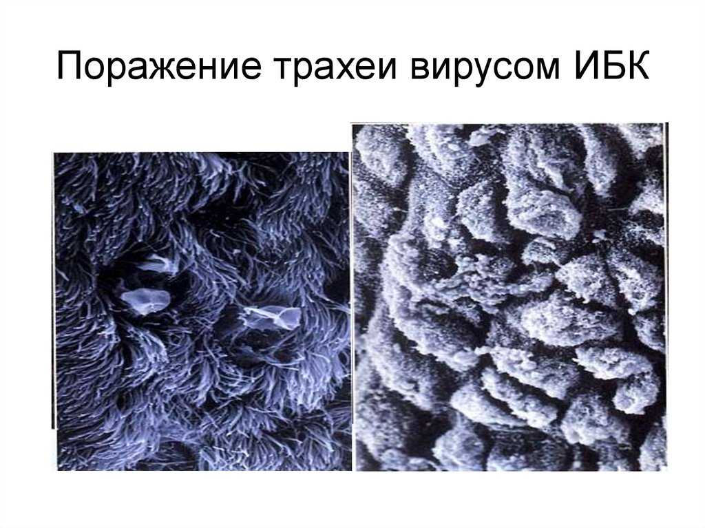 Инфекционный бронхит кур
