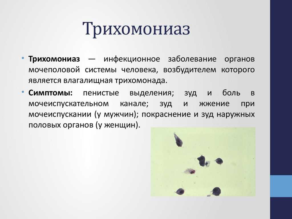 Трихомоноз у кур: симптомы, диагностика, лечение, меры профилактики, препараты