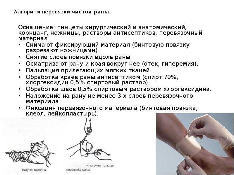 Самые распространенные способы наложения хирургических швов