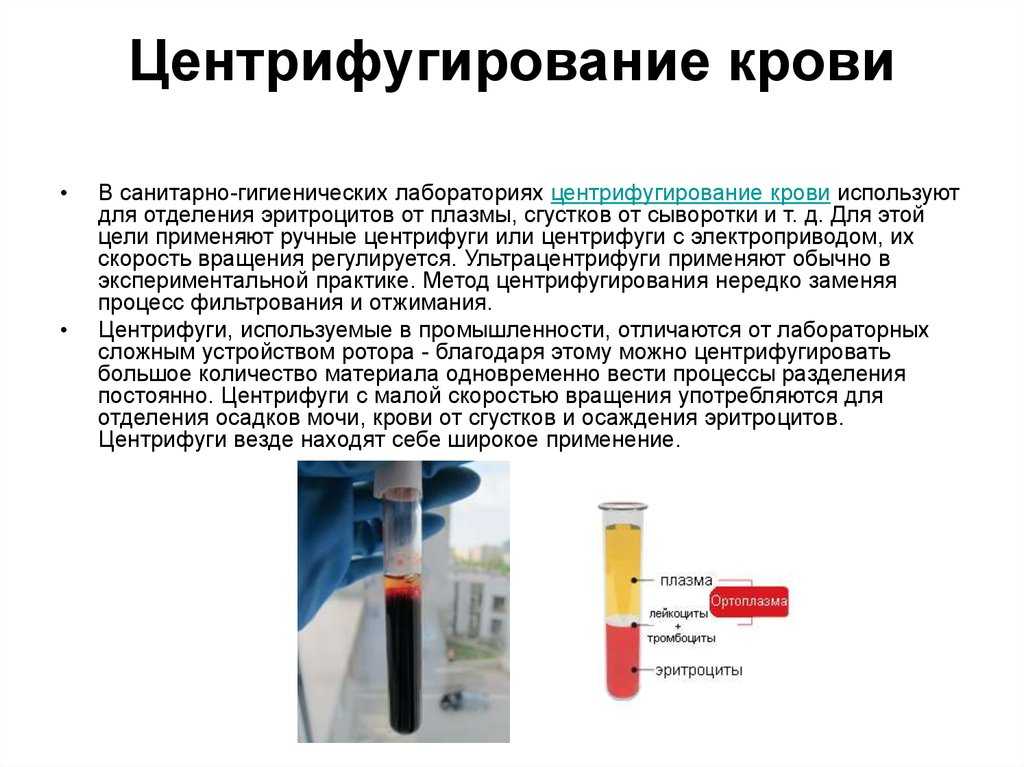 Сепаратор клеток крови для аутотрансфузии electa