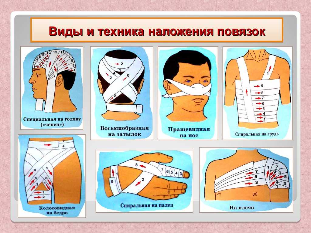 Виды повязок и общие требования их наложения